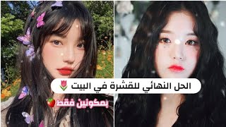 أقوى وأفضل طريقة للتخلص من القشرة 👸🍓 بمكونين فقط 💕