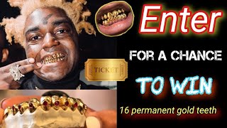 A chance to win 16 permanent gold teeth for $25 !! worth $5,800 WOW!!