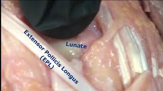 Joint Injections Procedures Lab | Radiocarpal Anatomy