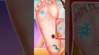 Asmr foot treatment surgery #youtubeshort #shortvideo