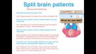 Brain and Body - VCE Psych exam pointers