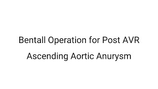 Open Heart Surgery | Bentall Operation for Post AVR Ascending aortic anurysm by Dr Yugal K Mishra