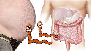 OMG! SECRET REVELED HOW TO DETOX, KILL WORMS & LOSE BELLY FAT FAST ! No Strict diet 1 kg in 1 week