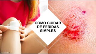 COMO CUIDAR DE FERIDAS SIMPLES? Por Luiz Gameiro, dermatologista