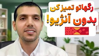 باز کردن رگ‌های قلب بدون نیاز به آنژیوپلاستی