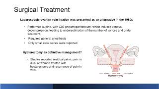 How Should Patients with Symptomatic Pelvic Venous Insufficiency Be Treated | Grand Rounds 5.19.2023