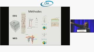 5 - Objectivation Des Acouphènes Et Nouvelles Approches Électrophysiologiques