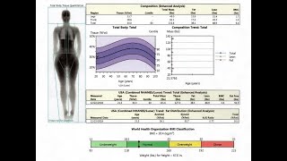 Bone Density Scanning and Results Score Analysis