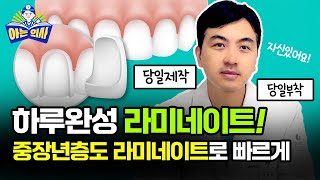 당일 라미네이트 가능하다는 말의 비밀, 하루만에 정말 가능하다고?