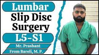 Lumbar Slip Disc Surgery (L5-S1) | Slip Disc Spine Surgery In Delhi