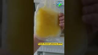 Fresh Frozen plasma | FFP | blood component | hemophilia treatment with FFP | blood banking