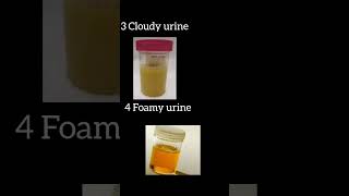 😍😍Urine analysis test procedure//🧪🧪 physical examination full details//Biochemistry Practicals//🥼🥼