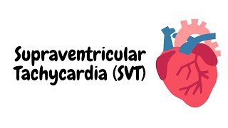 Supraventricular Tachycardia (SVT)