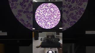 #Digitalmicroscope #pathologylaboratory #bloodtest #yt #ytshorts #ytviral #mbbs #viralvideo #shorts