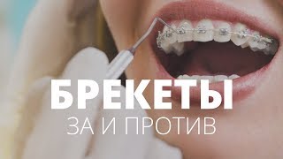 Всё, что вы хотели знать про брекеты, но боялись спросить