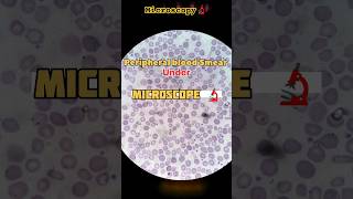 Peripheral blood Smear under Microscope 🔬 #viralvideo #medical #youtubeshorts #youtube #creator #lab