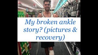 My Broken Ankle Recovery (Trimalleolar Fracture with Dislocation)