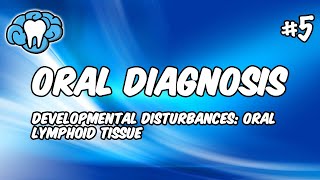 Oral Diagnosis | Developmental Disturbances of Oral Lymphoid Tissue | INBDE, ADAT