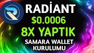 RADİANT RXD