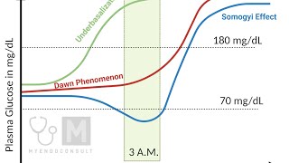 Dawn phenomenon and somogyi effect #diabetic