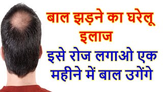 बाल झड़ने का उपाय | बालों का झड़ना कैसे बंद करें | गंजेपन का रामबाण तेल | बाल टूटने की दवा