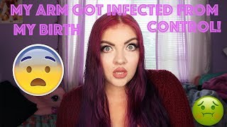 STORYTIME: My Arm Got Infected From My Birth Control! | Makayla Wetmore