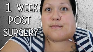 GRAPHIC CONTENT: ONE WEEK POST SURGERY (AMELOBLASTOMA) + MR. CJ'S B-DAY