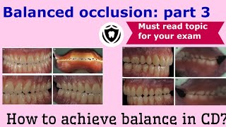 Balanced Occlusion in complete denture prosthesis Part 3