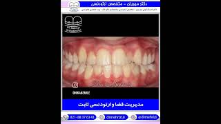 نمونه درمان ارتودنسی | دکتر احسان ابوئی مهریزی