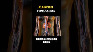 Diabetes | know ur risk | know ur response #pathology #diabetes #neetug #youtubeshorts #trending