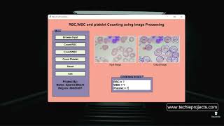 Blood Cell Classification using Image Processing | Blood Cell Detection and Counting using Python