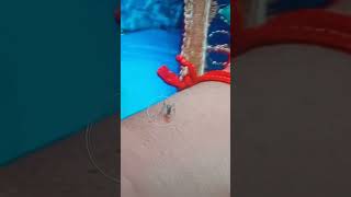 funny video mosquito 🦟