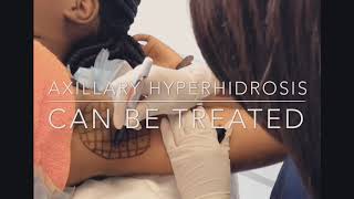 Axillary Hyperhidrosis- Dr Nandipha