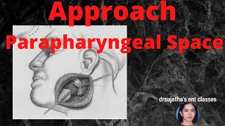 172.Approaches to parapharyngeal space #surgicalapproach  #parapharyngeal space #surgeryeducation