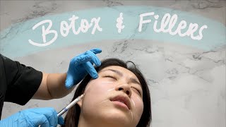 MY FIRST TIME GETTING BOTOX AND FILLERS (at 21 YEARS OLD)