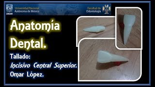 Tutorial de tallado de incisivo central superior Anatomía Dental