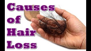 Causes of Hair Loss!