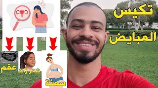 تكيس المبيض (اسباب، اعراض، تشخيص، علاج)