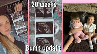 20 Week Bump Update With My Little Girl🩷