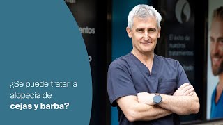 ¿Se puede tratar la alopecia de cejas y barba?