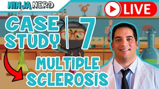 Case Study #7: Multiple Sclerosis