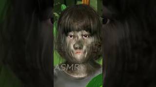 ASMR Maggot Infected & Hairy Face Removal Animation #shorts #ytshort #youtubeshorts