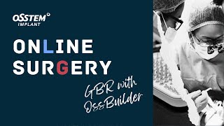 Online Surgery- Placing Implants at 43, 45 and 46 (GBR with OssBuilder)