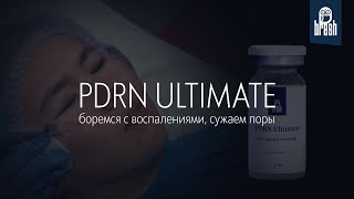 PDRN ULTIMATE против воспалений и расширенных пор