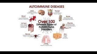 Environmental Triggers in the Development of Autoimmune Diseases