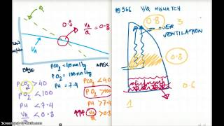 566 FA 12 : V/Q MISMATCH