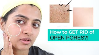 How to get rid of Open Pores?