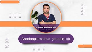 Anadangəlmə bud çanaq çıxığı. Anadangəlmə bud çanaq çıxığına nə səbəb olur?