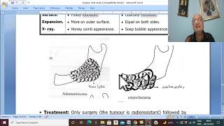 Surgical disorders of tongue and jaw  in Arabic 5 (Adamantinoma ) , by Dr. Wahdan