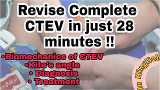 CTEV Simplified | Orthopaedics | Hinglish | Quick Revision | Neet PG | kite  angle | CTEV treatment